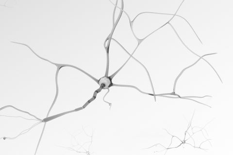 Aging, Free Radicals, and Antioxidants